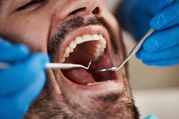 Best After-Hours Dental Trauma Care in Rose Hill, VA