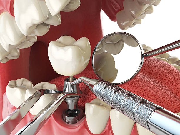Best Same-Day Emergency Dental Services in Rose Hill, VA